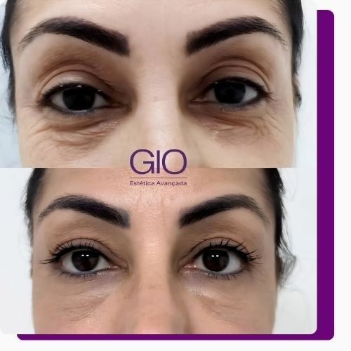 Na GIO Estética Avançada você encontra