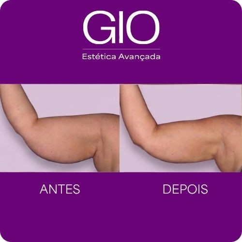Na GIO Estética Avançada você encontra: