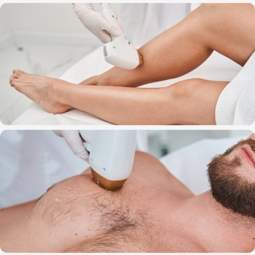 Depilação Feminina e Masculina